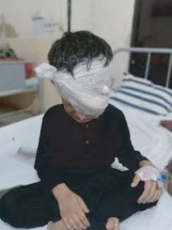 Free Specialized Ophthalmolodical (Eye) Care at JPMC, Karachi Saving Sights Transforming Lives!